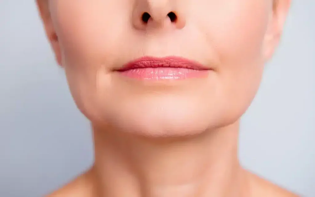 Managing Complex Cases: Dermal Fillers for Asymmetry and Structural Defects Managing Complex Cases: Dermal Fillers for Asymmetry and Structural Defects