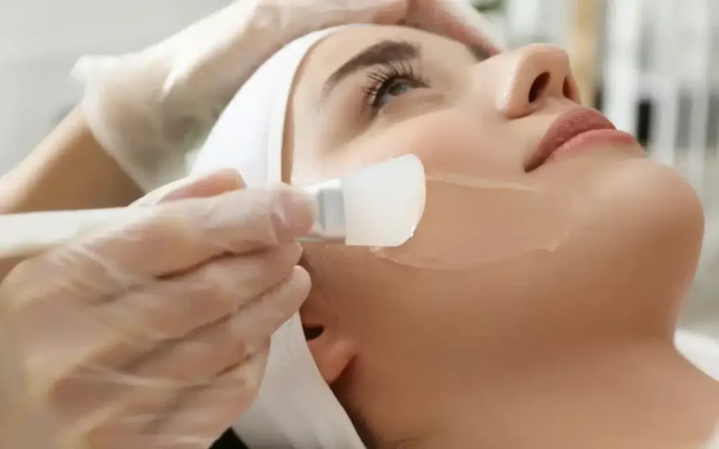 TCA Peels: Benefits for All Skin Types